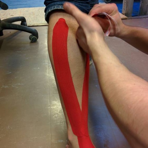 Kinesioteipin laittoa kipeään pohkeeseen